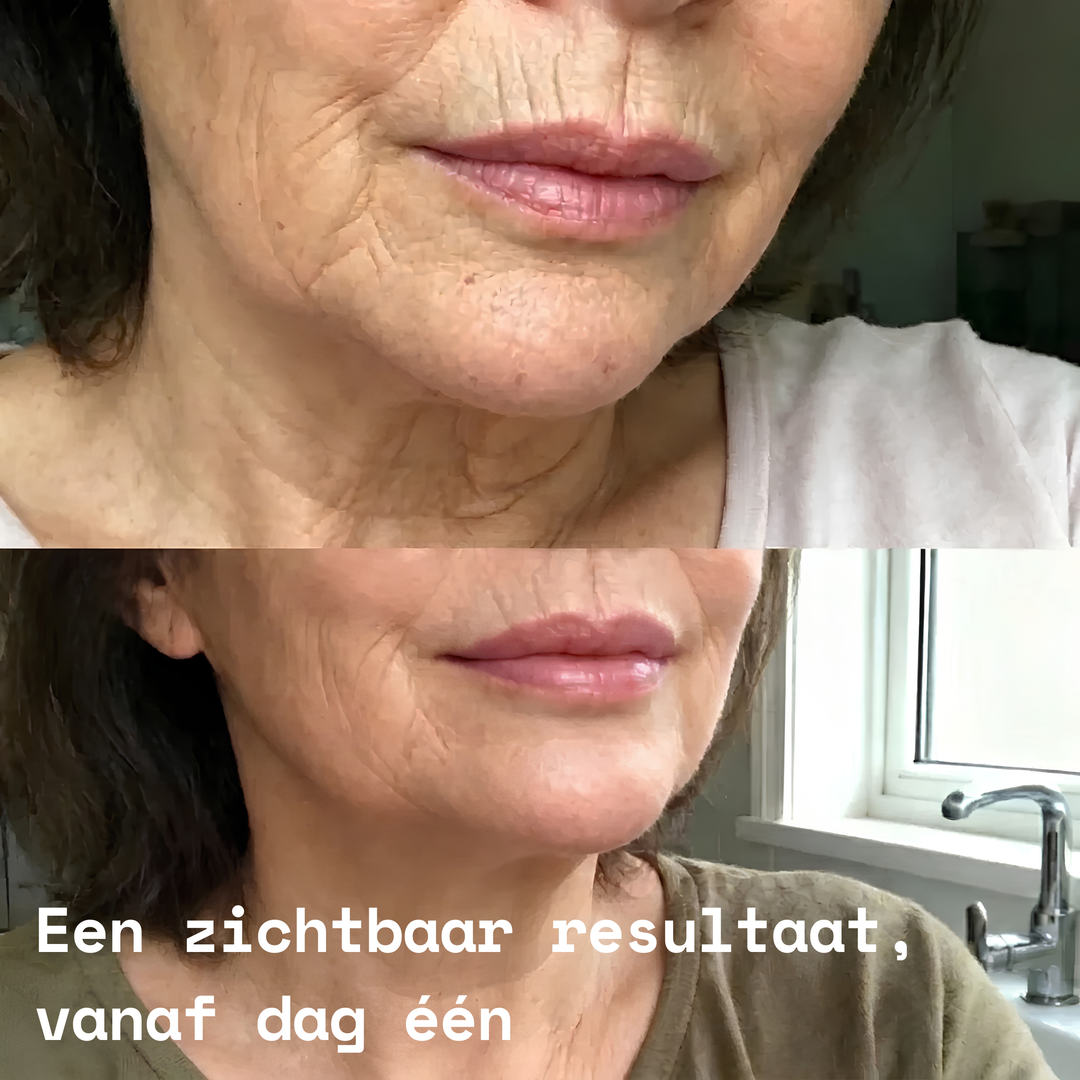 PDRN Bio-Collageen Balm