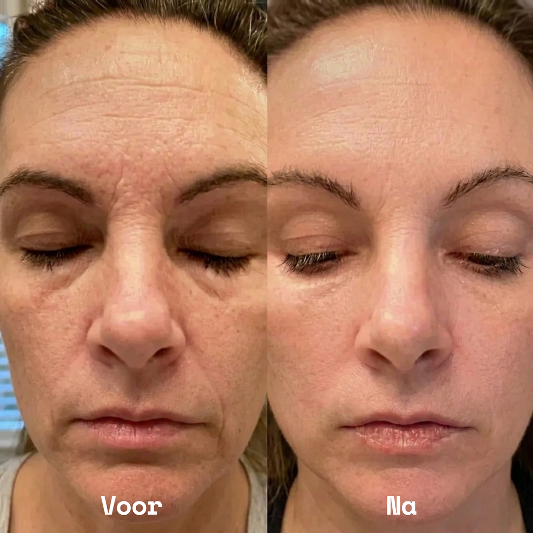 PDRN Bio-Collageen Balm